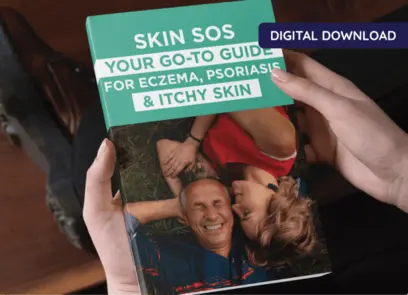 Skin SOS: Your Guide to Eczema